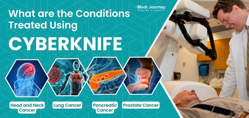 Cancers treated by CyberKnife