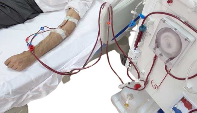 Understanding Dialysis: A Lifeline for Failing Kidneys